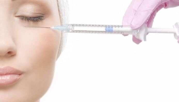 levantamiento de plasma